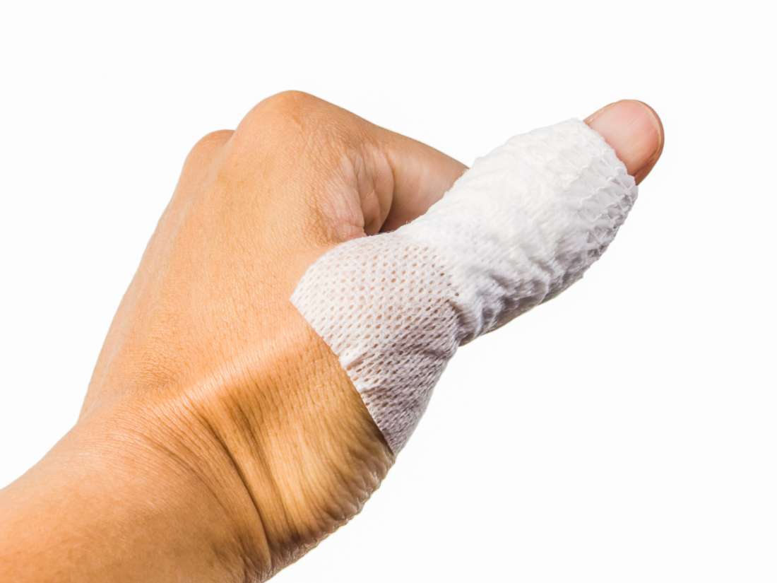 Trigger Thumb Surgery